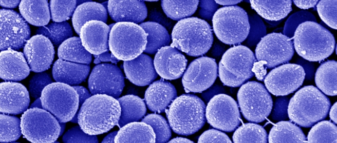 Methicillin-resistente Staphylococcus aureus (MRSA). Raster-Elektronenmikroskopie. Mastab = 500 nm. Quelle: Muhsin zel, Gudrun Holland, Rolf Reissbrodt (2004) 